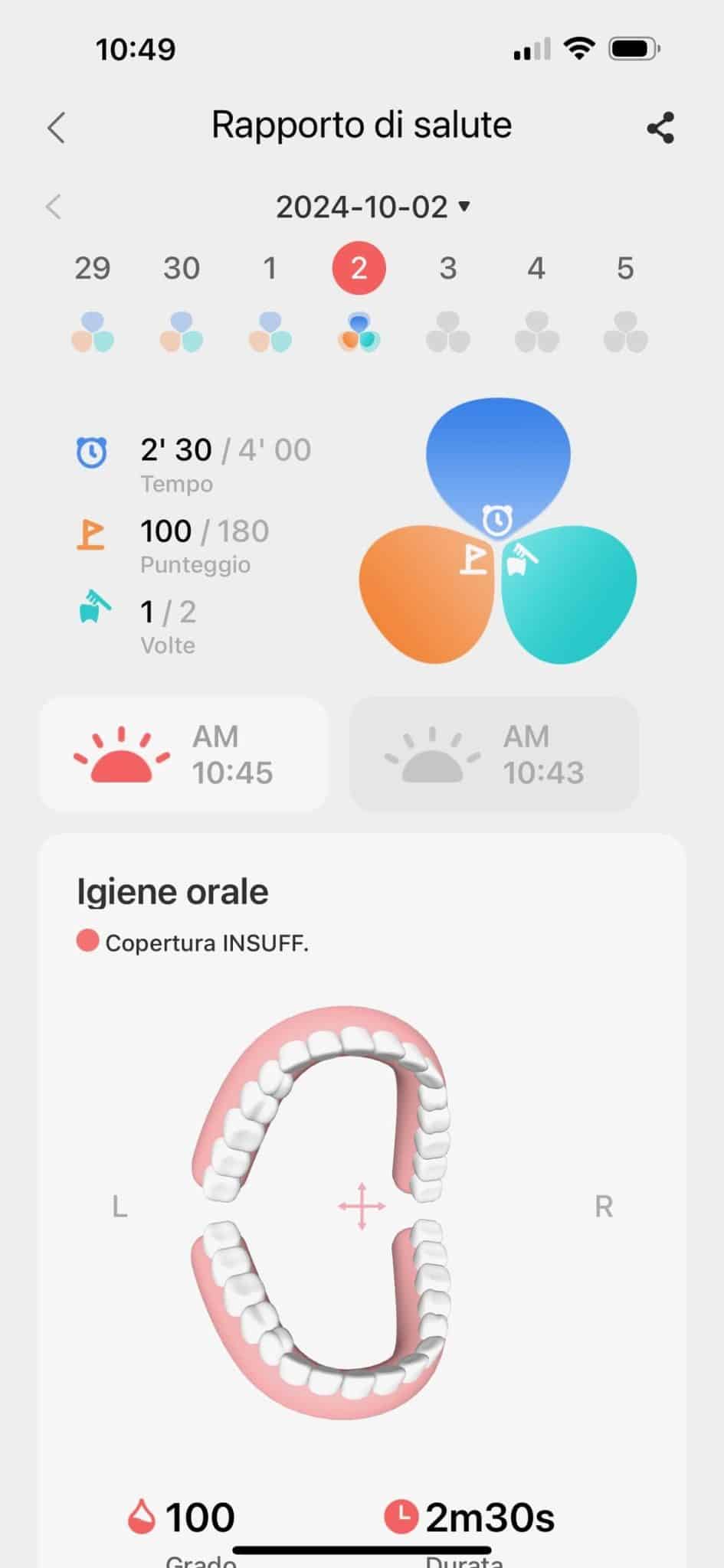 Recensione di Oclean X Pro Elite: anche il tuo sorriso diventa smart